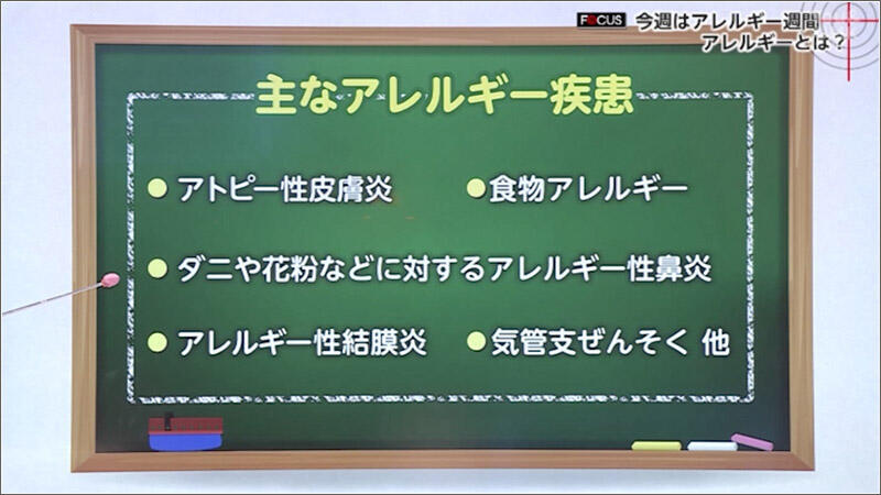 01 主なアレルギー疾患の種類